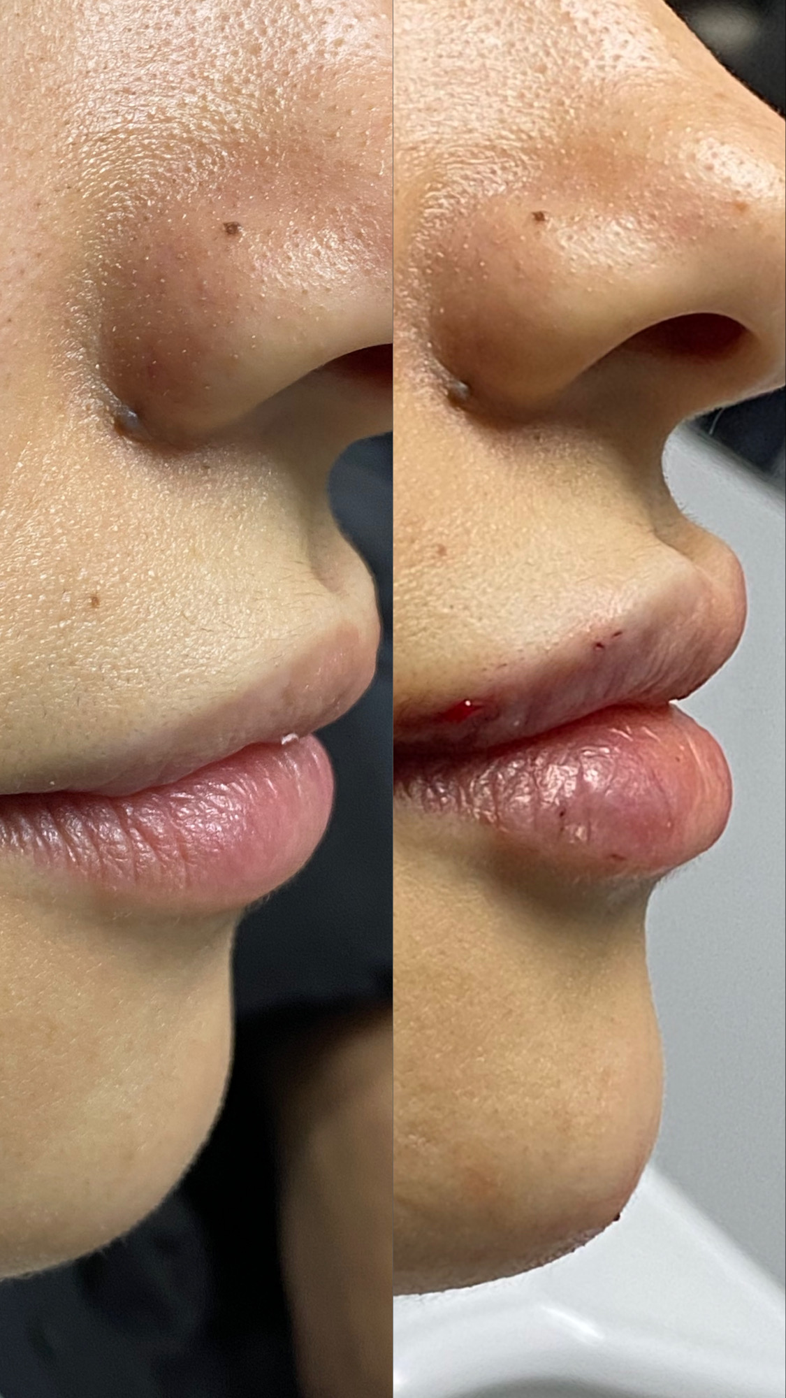 علاج تجميلي متكامل