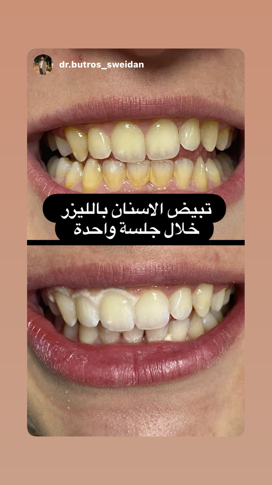 تجميل الأسنان