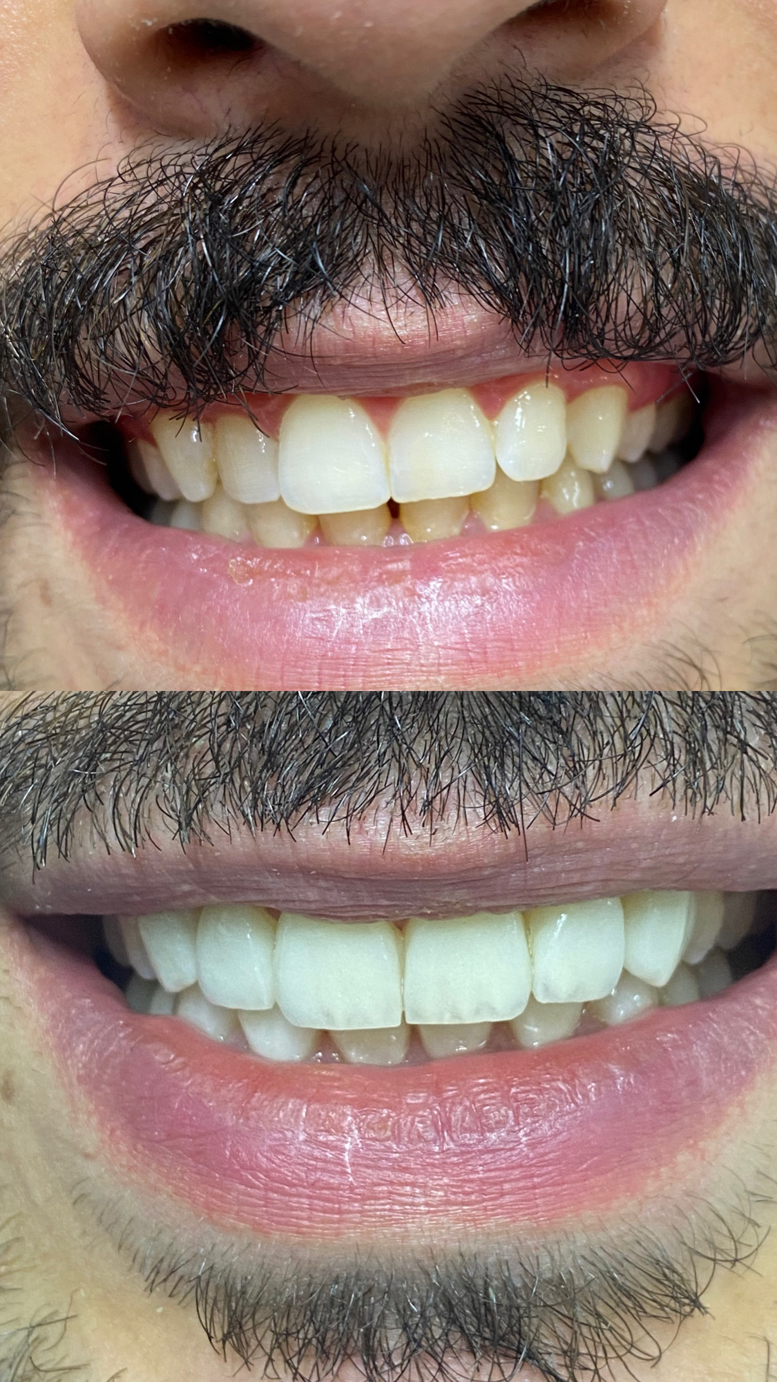 تجميل الأسنان